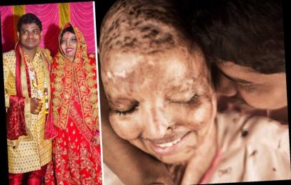 Acid attack survivor doused in petrol & set alight for 'rejecting marriage proposal' weds man she met on hospital ward