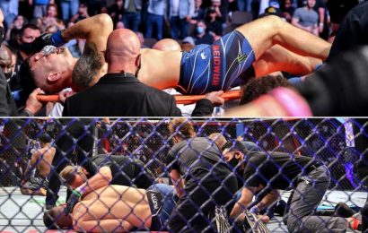 Chris Weidman shows just how gruesome leg injury at UFC 261 was