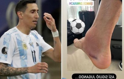 Angel Di Maria played on in Copa America final with horror swollen ankle after suffering injury in first half