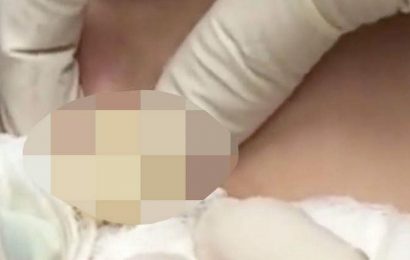Dr Pimple Popper makes viewers squirm as never-ending cyst keeps squirting pus