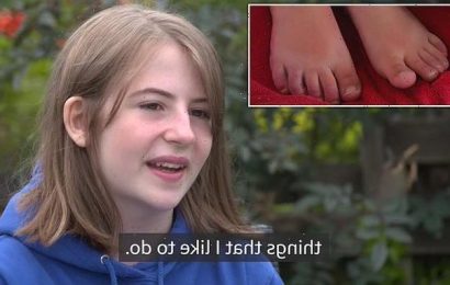 Teenager &apos;is barely able to walk&apos; because of Covid toes