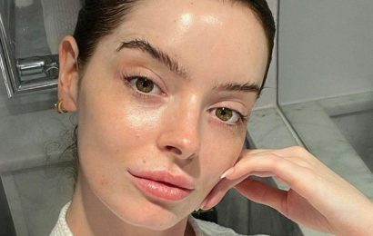 Maura Higgins shares acne breakout battle in raw makeup-free snap