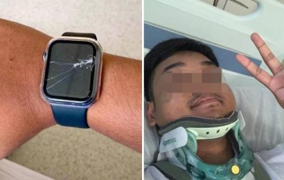 Dying crash victim saved by his APPLE WATCH that rang 999 after detecting his hard fall and no body movement