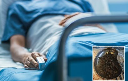Shocked surgeons find a kilogram of nails, screws and nuts in man's stomach he swallowed after quitting booze