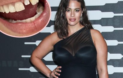 Ashley Graham Shares PAINFUL Photo Of Broken Tooth After Son Headbutts Her!