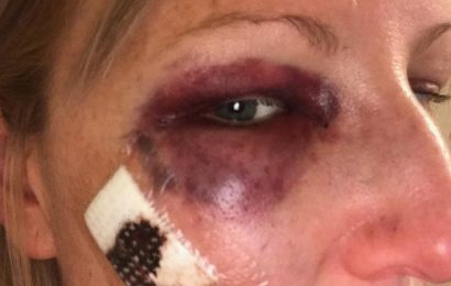 IBAC to review police investigation of police officer who punched woman