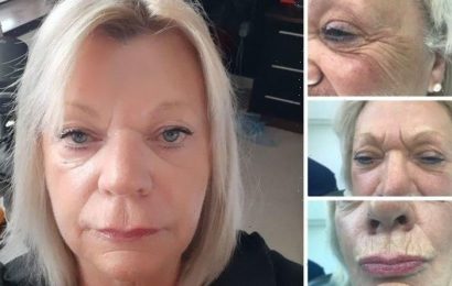 ‘More confident’: 70-year-old woman shares youthful transformation – but gives warning