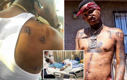 Rapper Slim 400 showed off chest riddled with bullet holes after being shot nine times – two years before he was killed