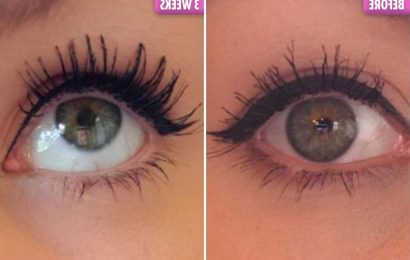 Women rave about £7.50 castor oil that has 3,000 five-star reviews on Amazon claiming it heals acne and REGROWS eyelashes
