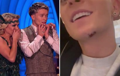 Dancing on Ice's Connor Ball reveals gruesome stitches after on-air accident that left him covered in blood