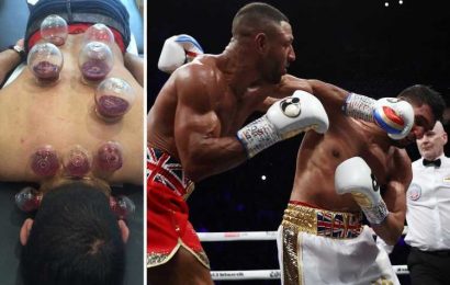 Fans convinced cupping is unlucky omen for fighters as Amir Khan is latest person to lose bout after treatment