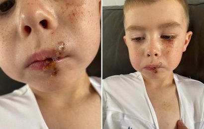 Boy, 4, savaged by dog while he went to the toilet as owner fined over horrific mauling