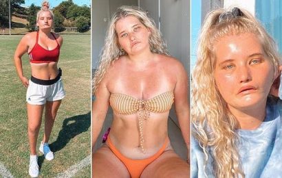 Tayla Clement, who has facial paralysis, signed a modelling contract