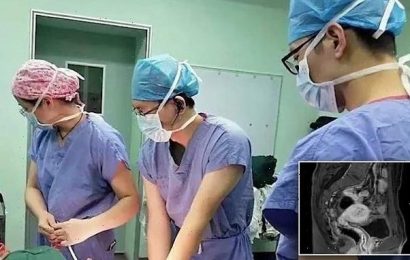 Chinese man told he was born with ovaries and a uterus after check-up