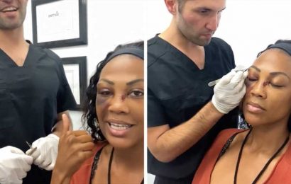 Olympian Kim Glass Gets 40 Stitches Removed From Eye Days After L.A. Attack
