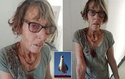 Grandmother, 66, is left bloodied after crazed seagull attack