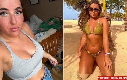 Size 10 woman is horrified to be told she&apos;s obese