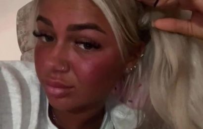 I’m obsessed with sunbeds and nasal tanning spray – trolls say I’ll regret it when I’m older but I love looking bronzed | The Sun