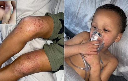 Mother shares footage of son, 4, struggling to breathe in mouldy flat