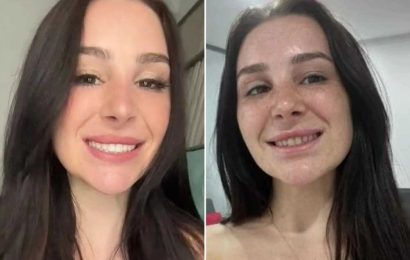 I travelled from Australia to Turkey for a set of new teeth – it cost me £4.3k but people wish they had my smile before | The Sun