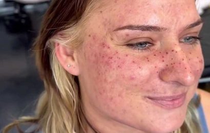 Tattooist proudly shows off client's new 'night sky' face inkings… but trolls reckon she looks like she has measles | The Sun