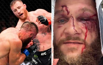 'We're born for this' – UFC star Rafael Fiziev shows off bloodied and battered face after war with Justin Gaethje | The Sun
