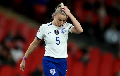 England&apos;s Leah Williamson will MISS the World Cup with an ACL injury