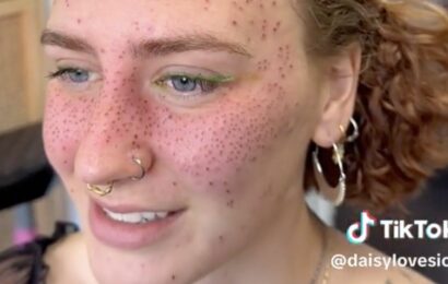 ‘I got fake freckles tattooed on my face – even if critics hate it’