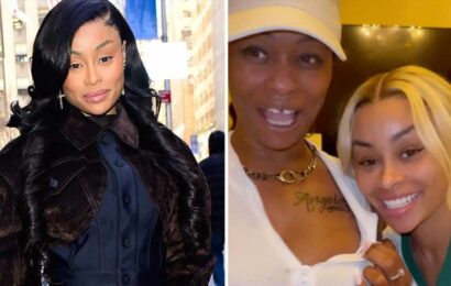 Blac Chyna Compares Herself to Old Photos of Her 'Crazy' Face, Shows Up Lips 'Went Down' Since Removing Filler