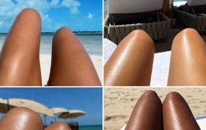 Celebrity Hot Dog Legs — Guess Who!