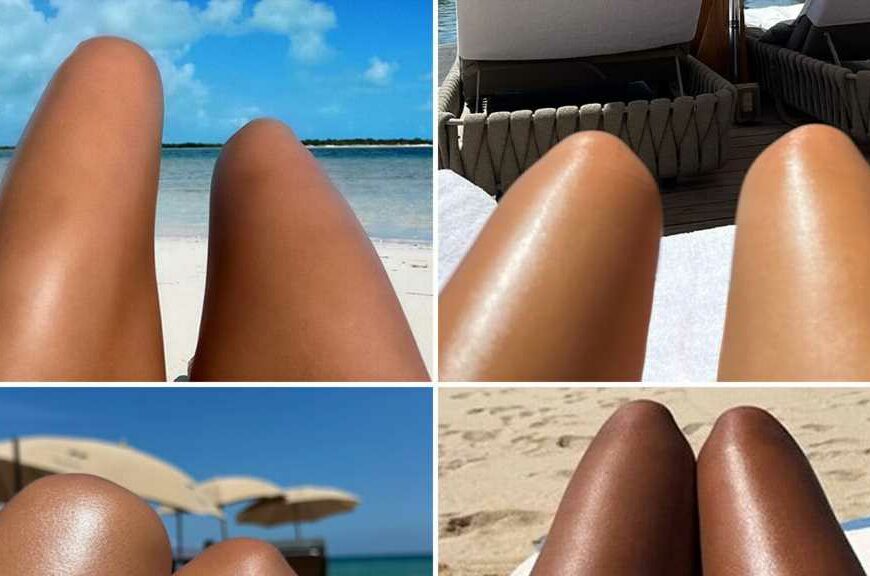 Celebrity Hot Dog Legs — Guess Who!