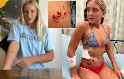 FL girl, 13, sitting in shallow water attacked by 6ft bull shark TWICE