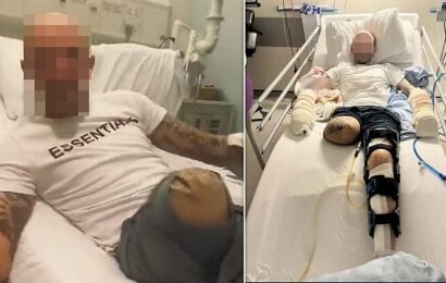 Man taunts gang who hacked off his leg in video from hospital bed