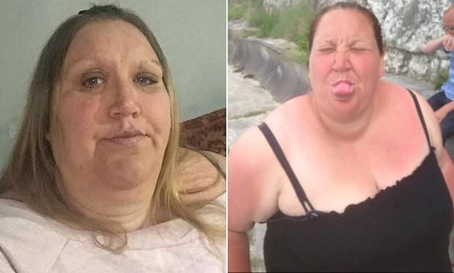 NHS staff fat-shamed 38-stone mother-of-four NHS staff fat-shamed 38-stone mother-of-four