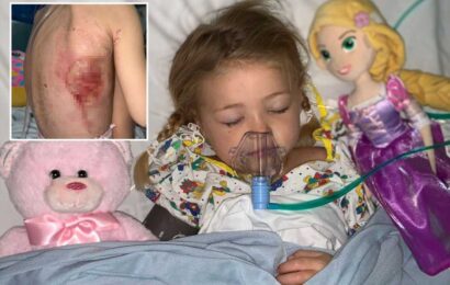 Mum issues urgent warning after chickenpox left little girl, 5, fighting for life with flesh-eating bug | The Sun